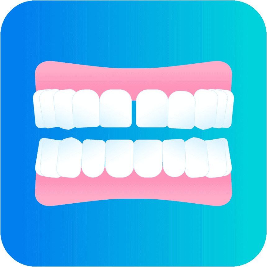 Misaligned teeth malocclusion diastema