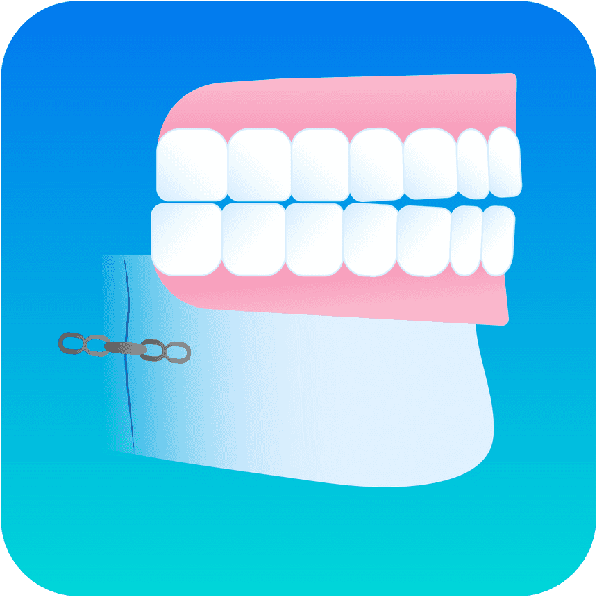 Illustration dental surgery